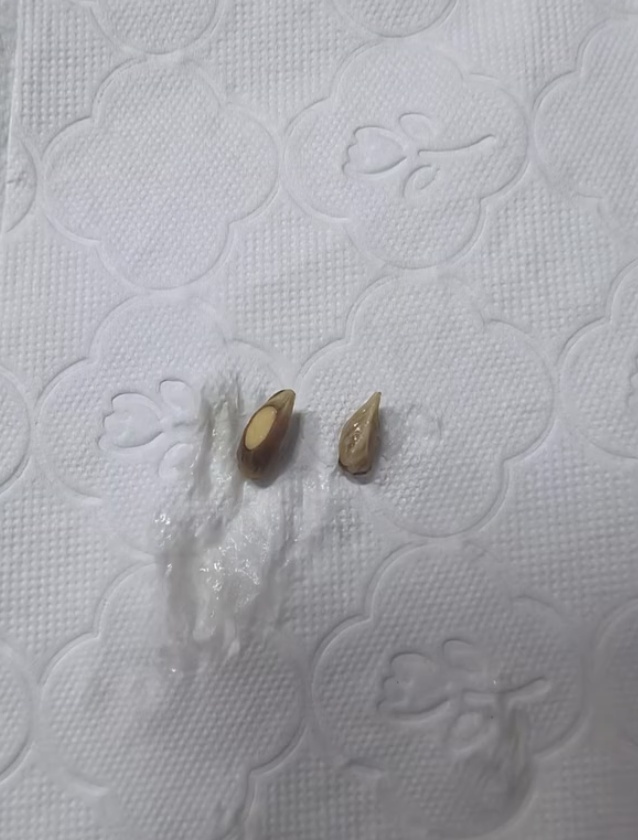 网友称喝柠檬茶被柠檬籽卡伤喉咙追责商家，商家回应正在处理，医生提醒
