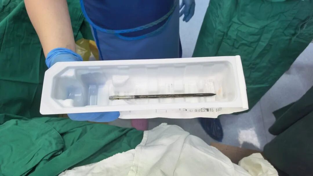 广东一男子除草时被18厘米钢钻刺穿右眼，贯穿整个头颅，距离大动脉仅数毫米