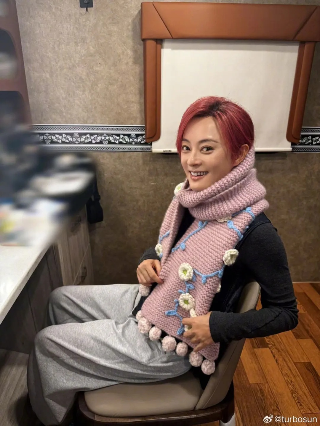 孙俪拍戏后眼睛血管破裂，医生给出提醒：情绪剧烈激动是眼血管破裂主要诱因