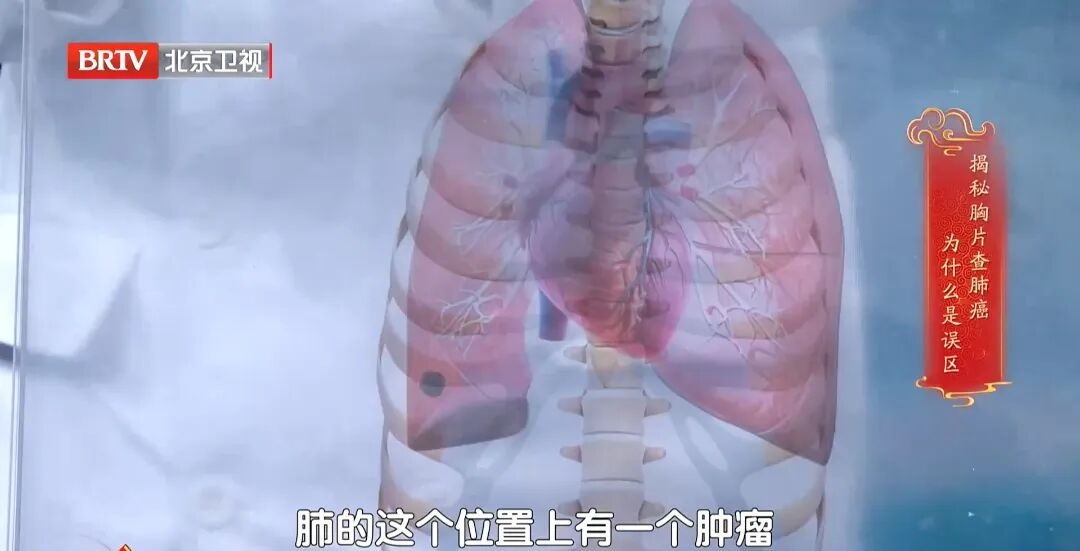 身体出现这种表现，3个月内癌症风险可能高8倍？看完赶紧查，别拖