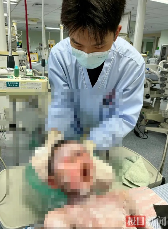 9岁男童全身大面积皮肤剥脱、溃烂，元凶几乎家家都有！