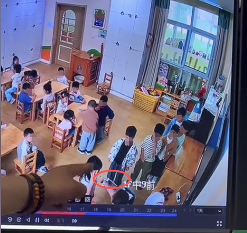 江苏一幼师用热熔胶枪烫伤儿童嘴巴？官方通报