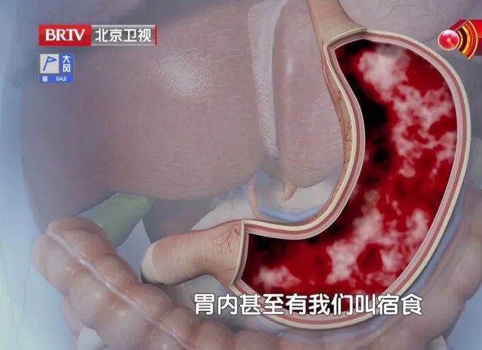 身上藏着两个“养胃穴”,一按就灵,消食化积、赶跑反酸,脾胃越来越强壮 身上藏着两个“养胃穴”,一按就灵,消食化积、赶跑反酸,脾胃越来越强壮