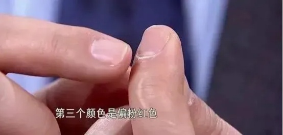 指甲能预示身体问题?要警惕这5种指甲变化,一个比一个危险 指甲能预示身体问题?要警惕这5种指甲变化,一个比一个危险