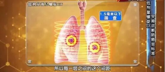 指甲能预示身体问题?要警惕这5种指甲变化,一个比一个危险 指甲能预示身体问题?要警惕这5种指甲变化,一个比一个危险