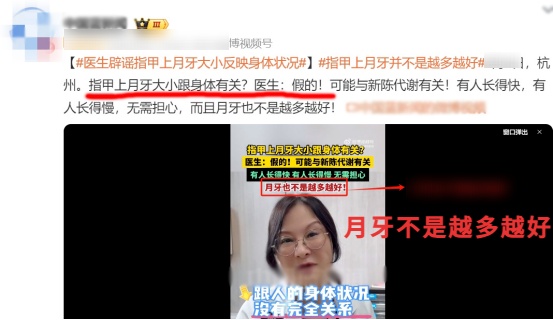 指甲能预示身体问题?要警惕这5种指甲变化,一个比一个危险 指甲能预示身体问题?要警惕这5种指甲变化,一个比一个危险