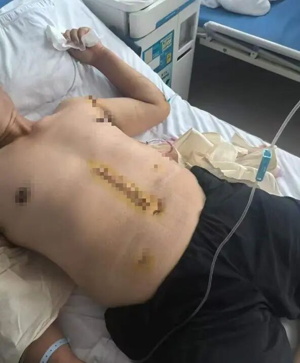 疑打井纠纷，河北邯郸一小学教师杀害33岁邻居，当地警方已介入