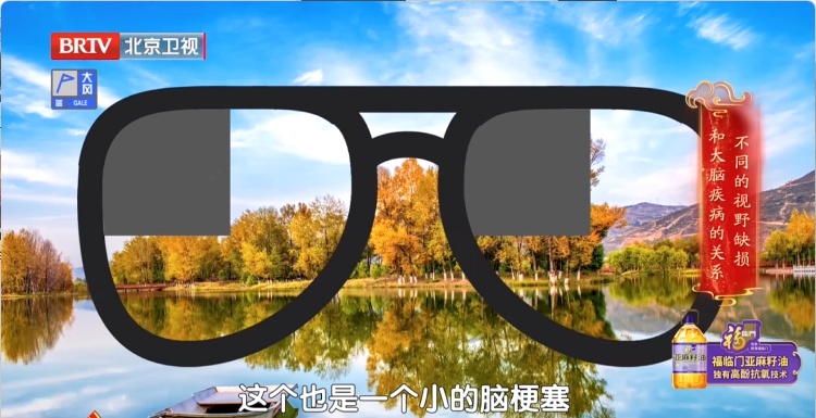 脑梗来临，眼睛先知？出现这3种改变，是脑梗的“最后通牒”！千万别拖