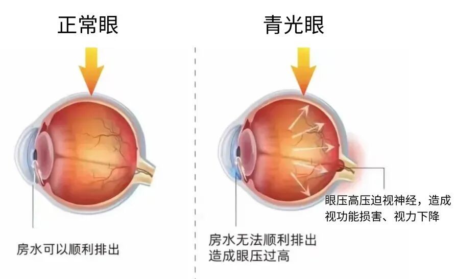 今天起，别用这种姿势午睡
