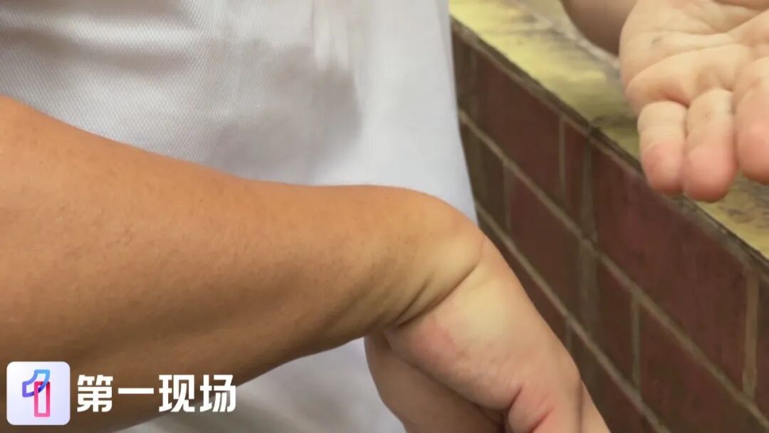 深圳动真格了！发现蚊虫隐患尽管“随手拍”，有人来处理！