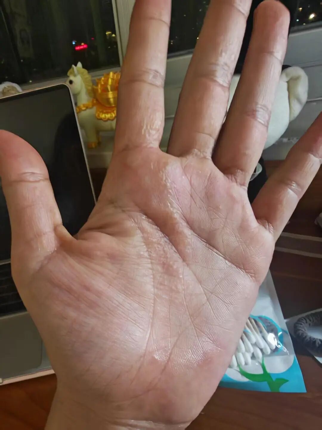 告别夏季皮肤困扰！4种高发皮肤病一次性讲清