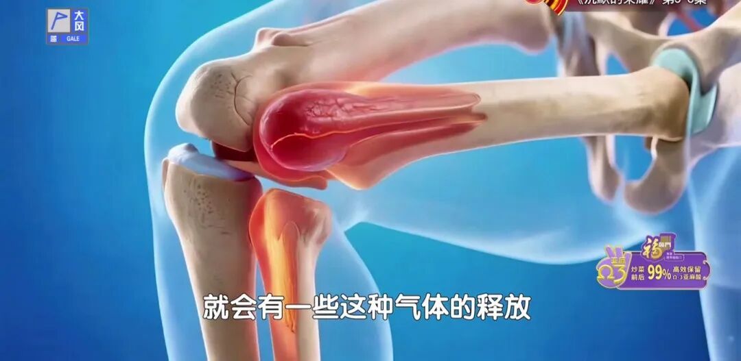 骨科医生提醒：这种椅子伤髋毁膝，劝你别坐，每天抬抬腿，膝盖不酸胀，走路更稳当