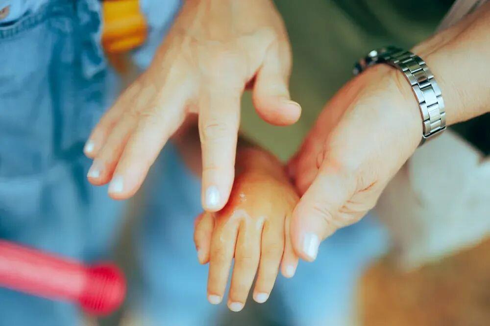 被蚊子咬了如何快速止痒？这四个方法收藏好