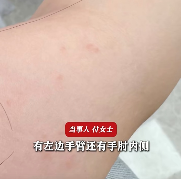 拍照时一个动作,女子中毒过敏!网友搬出《甄嬛传》台词→ 拍照时一个动作,女子中毒过敏!网友搬出《甄嬛传》台词→