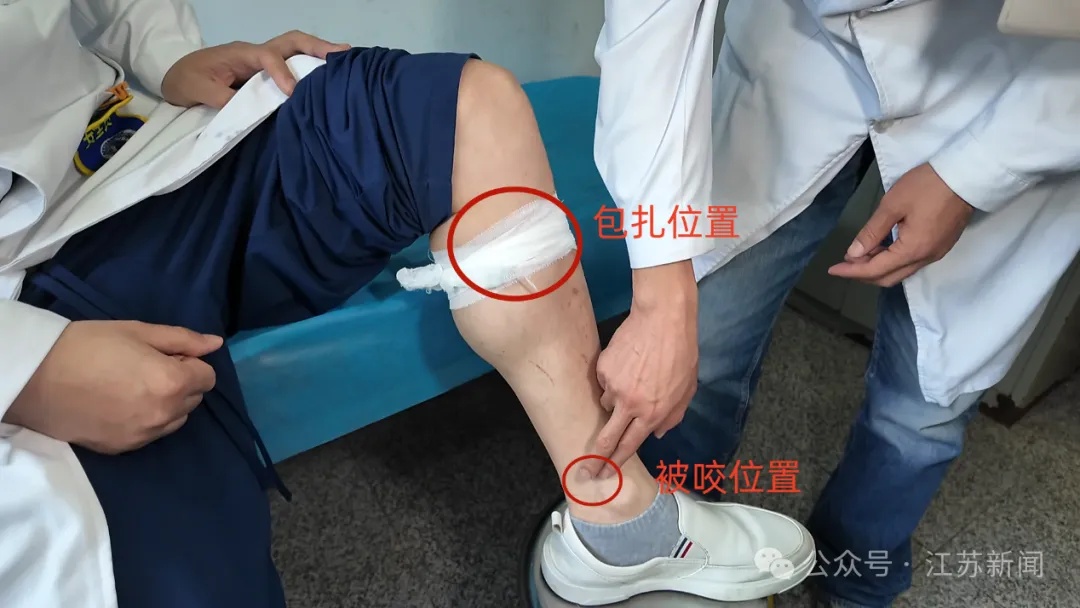 男子田间干活被毒蛇咬伤，几个自救动作获医生点赞！近期蛇咬伤多发，做对急救能保命