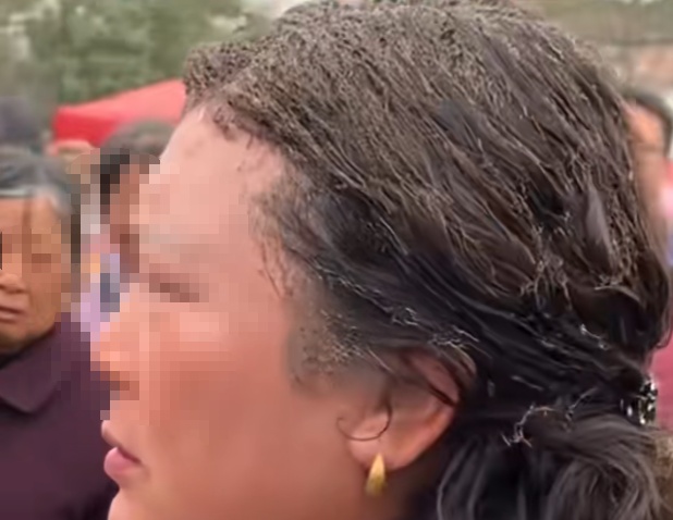男子违规自制“小手雷”导致自己和妻子被烧伤！更可怕的是，他还敢再犯！
