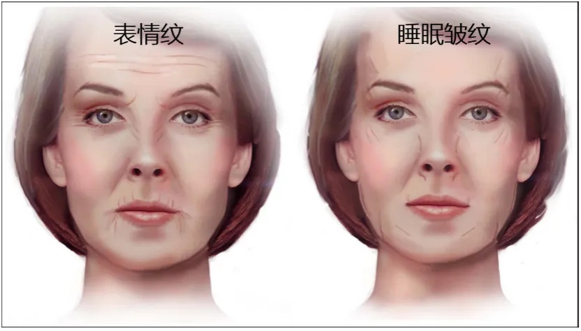 现在起,午睡姿势调整一下 现在起,午睡姿势调整一下
