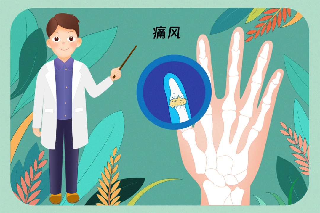 痛风可导致“看不见”的伤害 痛风可导致“看不见”的伤害