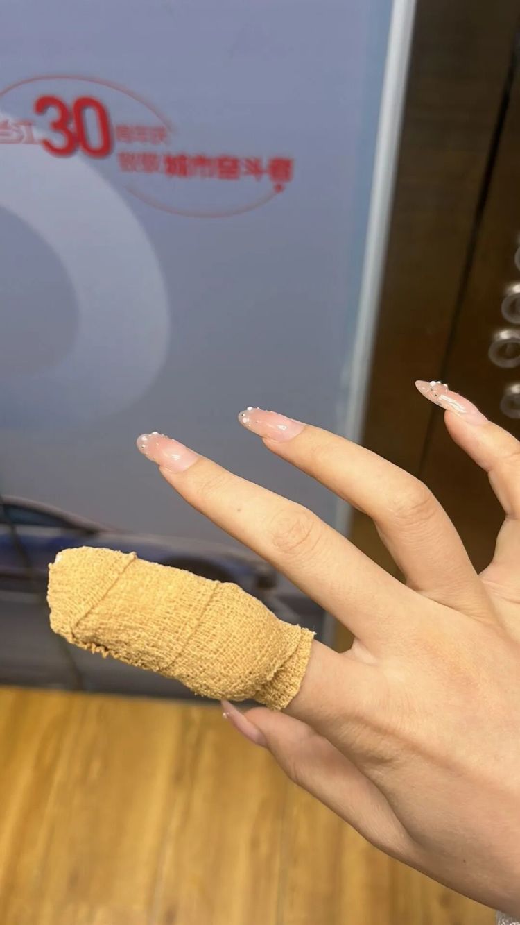 太痛了!女子食指甲床撕裂紧急就医,频繁做美甲,本甲薄得透光,医生提醒→ 太痛了!女子食指甲床撕裂紧急就医,频繁做美甲,本甲薄得透光,医生提醒→