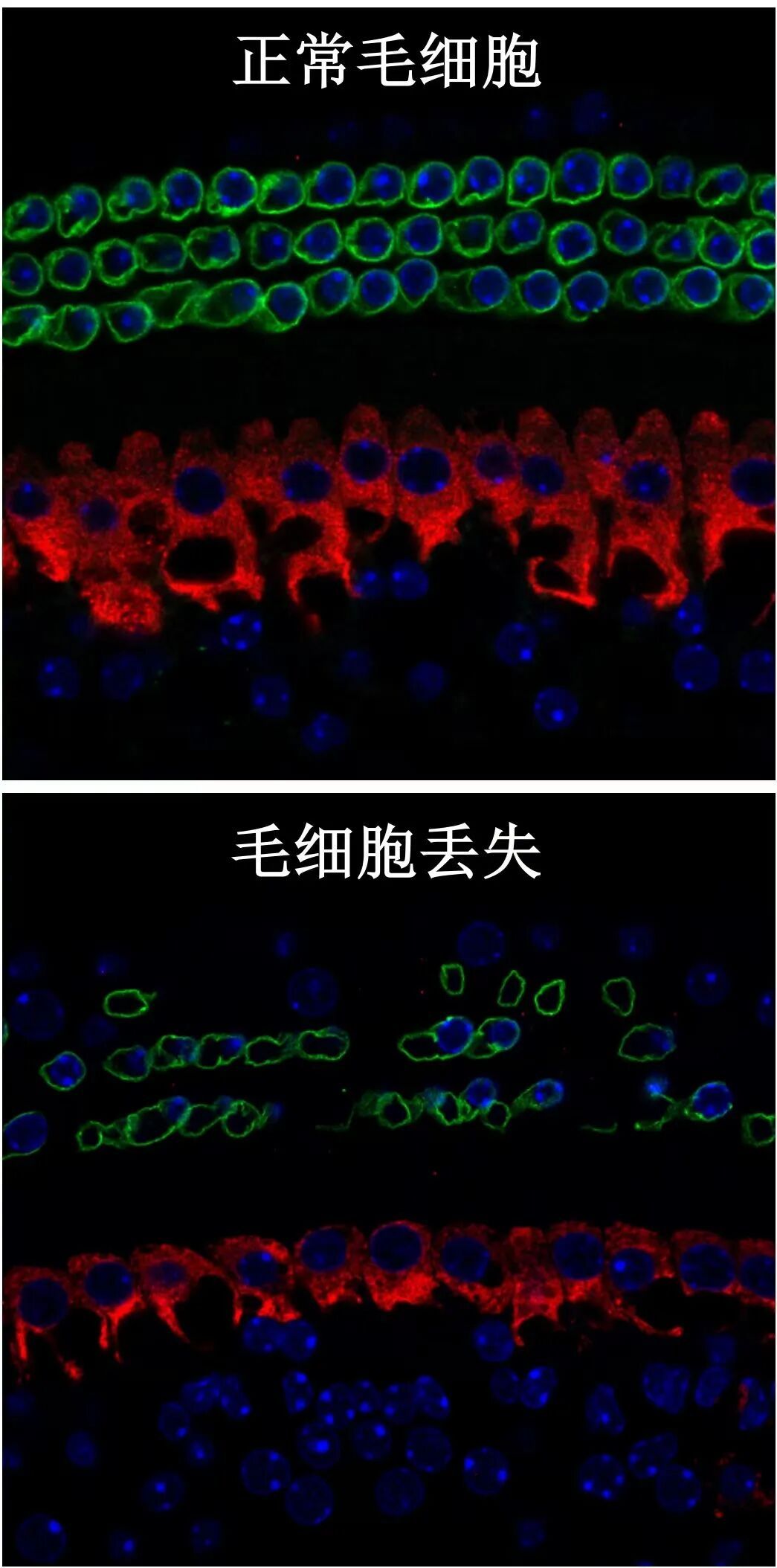 大学生戴耳机入睡,耳机在耳朵里爆炸:非“杂牌”,此前未出现异常 大学生戴耳机入睡,耳机在耳朵里爆炸:非“杂牌”,此前未出现异常