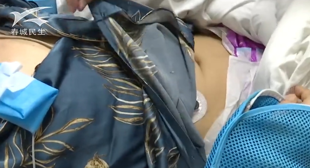 云南一男子吃菌中毒后幻想在“修仙”,突然翻出27楼窗户往下爬,被救后直呼:戒了戒了 云南一男子吃菌中毒后幻想在“修仙”,突然翻出27楼窗户往下爬,被救后直呼:戒了戒了