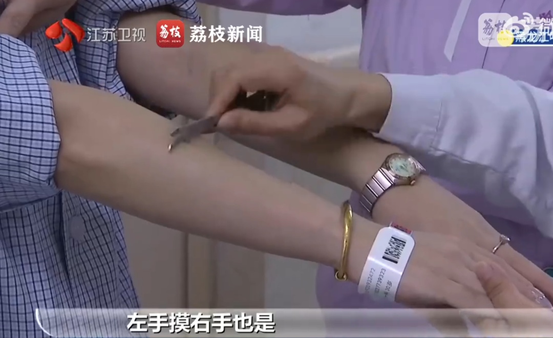 “摸到了，但没感觉！”30岁女子突然患上“美女病”，这病常被误诊漏诊……
