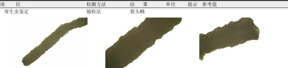 女子手臂取出2条10多厘米活虫!医生:肿块会动就可能是它 女子手臂取出2条10多厘米活虫!医生:肿块会动就可能是它