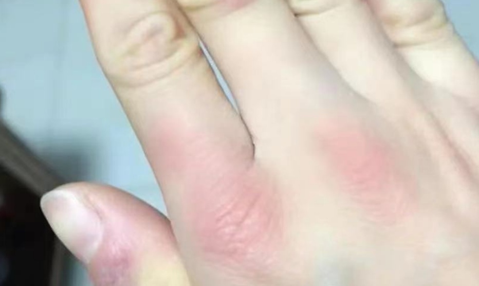 25岁怀孕女子突然确诊!坚持保胎后多器官衰竭进ICU,丈夫后悔痛哭!警惕这些症状 25岁怀孕女子突然确诊!坚持保胎后多器官衰竭进ICU,丈夫后悔痛哭!警惕这些症状