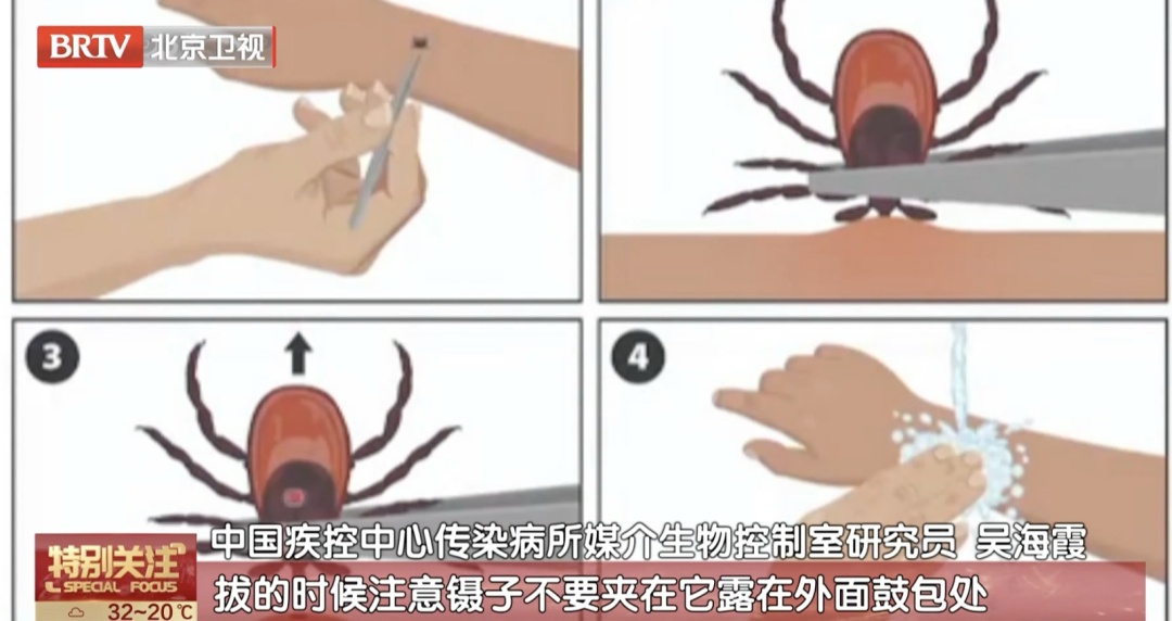 小心！北京多人被叮咬，已有死亡病例！专家紧急提醒——