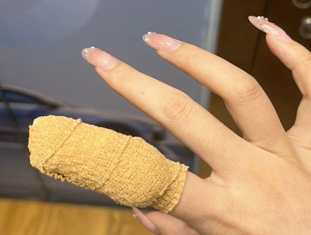 女子做家务时突然一阵钻心疼,指甲直接断裂渗血! 女子做家务时突然一阵钻心疼,指甲直接断裂渗血!