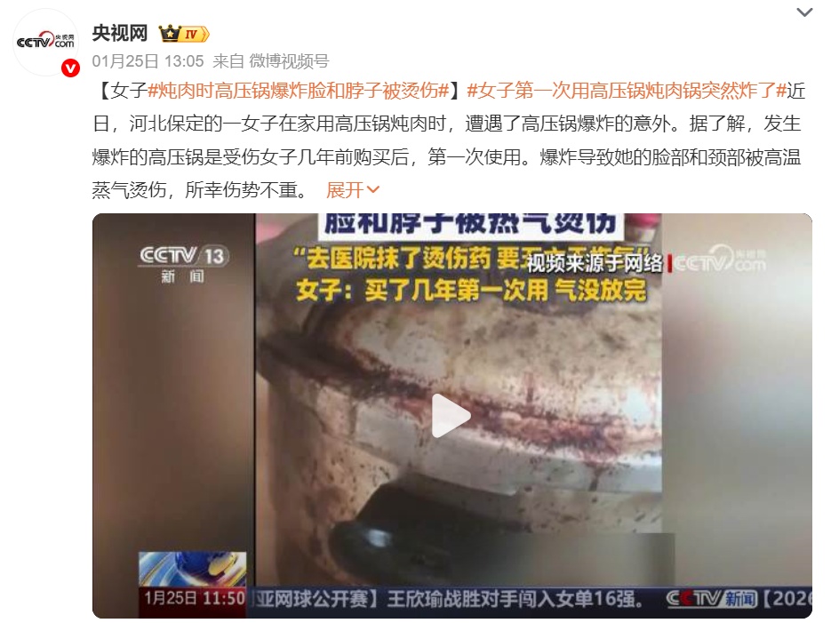 砸穿天花板!煲汤“搭子”突然“炸了”,一女子颅脑重伤被送EICU! 砸穿天花板!煲汤“搭子”突然“炸了”,一女子颅脑重伤被送EICU!