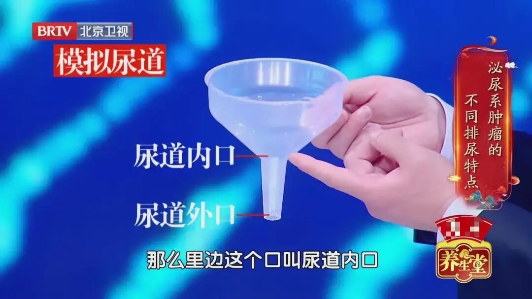 排尿时出现这3种异常,可能是身体在悄悄“报警”!别不当回事 排尿时出现这3种异常,可能是身体在悄悄“报警”!别不当回事