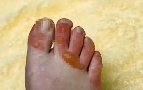 真的会炸!保温杯里放这几样东西,当心秒变“炸弹”! 真的会炸!保温杯里放这几样东西,当心秒变“炸弹”!