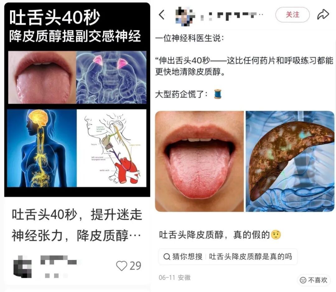 伸舌头能降皮质醇?神经科医生:过度演绎了! 伸舌头能降皮质醇?神经科医生:过度演绎了!