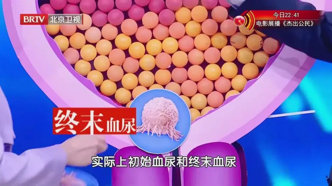 排尿时出现这3种异常,可能是身体在悄悄“报警”!别不当回事 排尿时出现这3种异常,可能是身体在悄悄“报警”!别不当回事