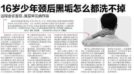 孩子脖颈莫名发黑 警惕胰岛素抵抗 孩子脖颈莫名发黑 警惕胰岛素抵抗