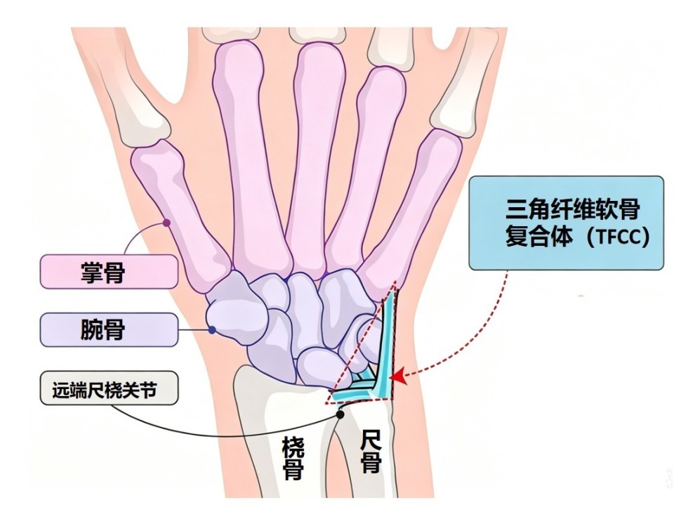 手腕小指一侧隐隐作痛?医生提醒:勿当腱鞘炎,可能是TFCC损伤! 手腕小指一侧隐隐作痛?医生提醒:勿当腱鞘炎,可能是TFCC损伤!