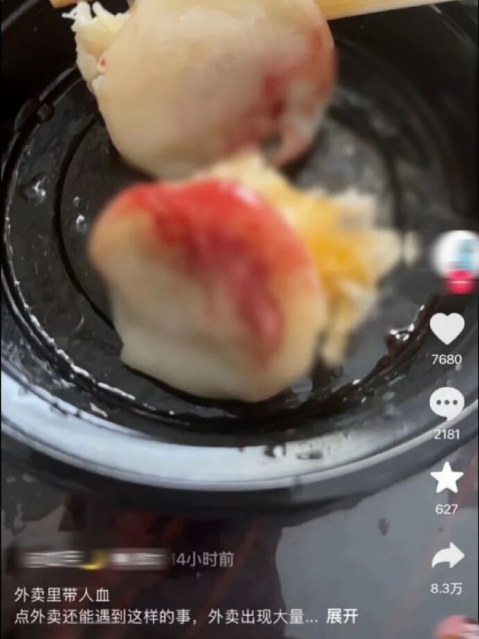 外卖吃出大量血迹 ,男子自行就医并服用阻断药,店方回应—— 外卖吃出大量血迹 ,男子自行就医并服用阻断药,店方回应——