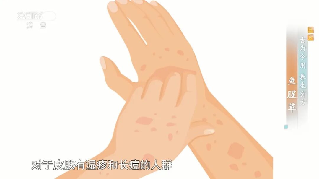 你家餐桌上的它是“天然抗生素”,消炎、抗菌、解毒、消暑,夏天这样吃正合适~ 你家餐桌上的它是“天然抗生素”,消炎、抗菌、解毒、消暑,夏天这样吃正合适~