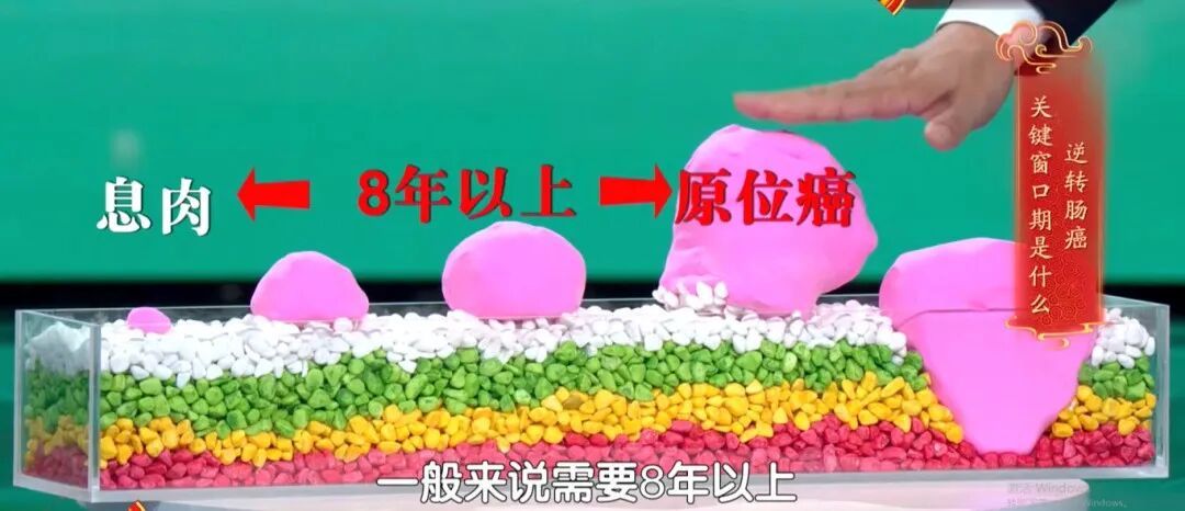 35岁后,你的“第二大脑”是防癌的关键,90%的人都忽略了 35岁后,你的“第二大脑”是防癌的关键,90%的人都忽略了