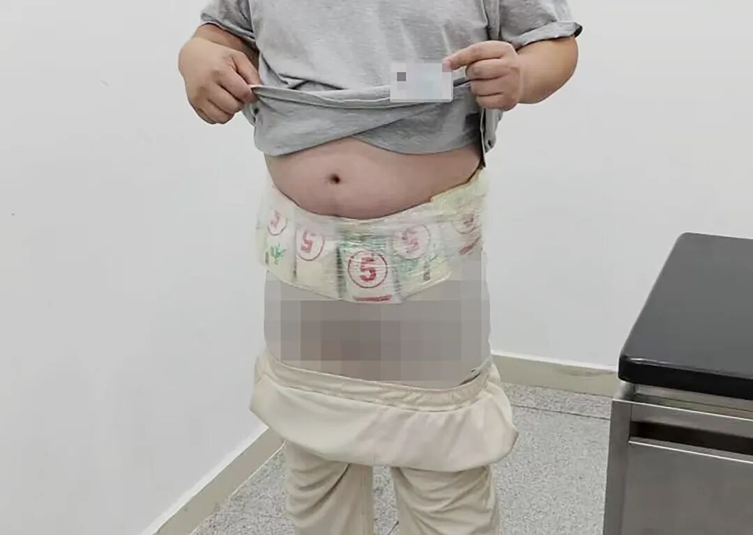 一男子经过拱北口岸时,关员从其腰腹处查获用塑料薄膜绑藏的8包银珠,共10千克,目前,该案正在进一步办理中 一男子经过拱北口岸时,关员从其腰腹处查获用塑料薄膜绑藏的8包银珠,共10千克,目前,该案正在进一步办理中