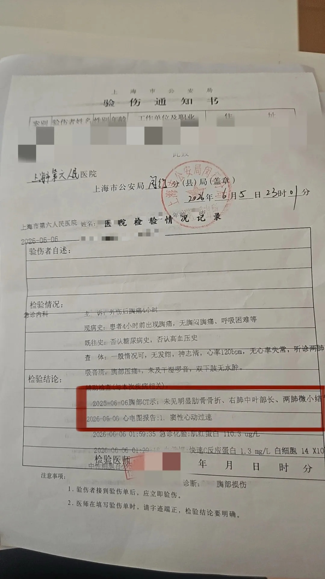 “有孕妇，不要抽烟”男子餐馆内劝阻吸烟者反被殴打，打人者被罚500元......