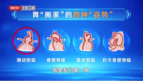 这件“舒服事”正加速毁胃,很多人每天都在做!还有这4类食物,劝你要少吃 这件“舒服事”正加速毁胃,很多人每天都在做!还有这4类食物,劝你要少吃