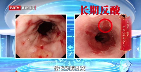 这件“舒服事”正加速毁胃,很多人每天都在做!还有这4类食物,劝你要少吃 这件“舒服事”正加速毁胃,很多人每天都在做!还有这4类食物,劝你要少吃