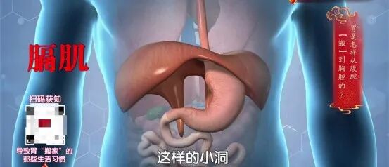 这件“舒服事”正加速毁胃,很多人每天都在做!还有这4类食物,劝你要少吃 这件“舒服事”正加速毁胃,很多人每天都在做!还有这4类食物,劝你要少吃