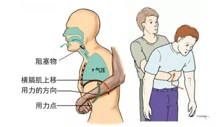 吃了块鲍鱼差点没命!家人有这种情况一定要注意—— 吃了块鲍鱼差点没命!家人有这种情况一定要注意——