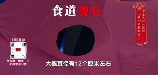 这件“舒服事”正加速毁胃,很多人每天都在做!还有这4类食物,劝你要少吃 这件“舒服事”正加速毁胃,很多人每天都在做!还有这4类食物,劝你要少吃