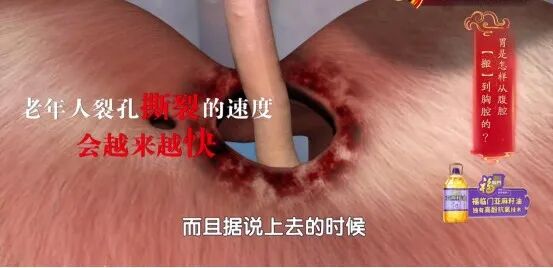 这件“舒服事”正加速毁胃,很多人每天都在做!还有这4类食物,劝你要少吃 这件“舒服事”正加速毁胃,很多人每天都在做!还有这4类食物,劝你要少吃