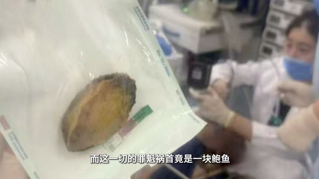吃了块鲍鱼差点没命!家人有这种情况一定要注意—— 吃了块鲍鱼差点没命!家人有这种情况一定要注意——