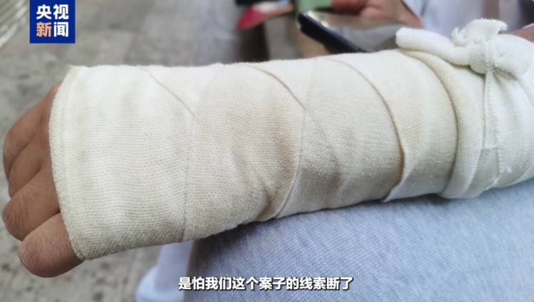 膝盖留下狰狞疤痕 全身16处被马蜂蜇伤 致敬这些缉毒英雄 膝盖留下狰狞疤痕 全身16处被马蜂蜇伤 致敬这些缉毒英雄